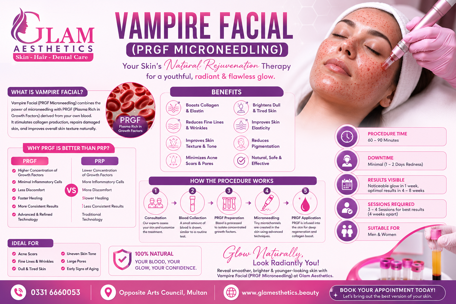 Vampire Facial: The Secret to Naturally Radiant, Youthful Skin at Glam Aesthetics & Dental Care Multan